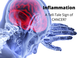 Inflammation, Cancer and Collagen - cause, effect and prevention