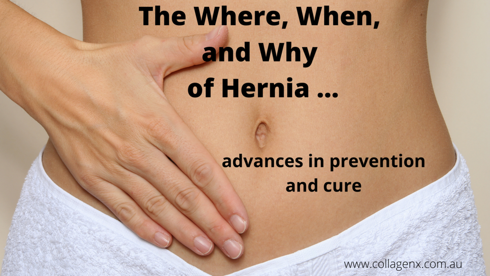 The How, When, Where and Why of Hernia - advances in prevention and cure