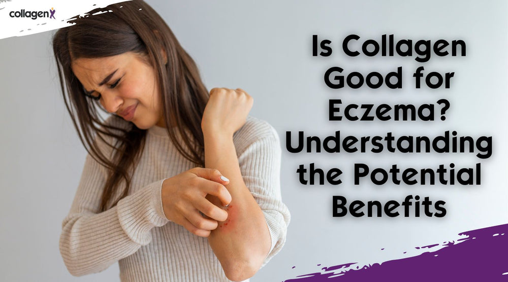 Is Collagen Good for Eczema? Understanding the Potential Benefits